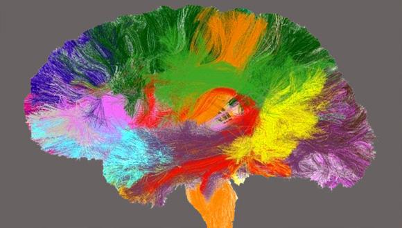 A new 'atlas' of the brain will help improve research and medical care. (Photo courtesy of Denis Le Bihan and his team.)