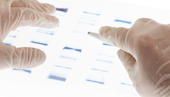 Illustrative: Examination of DNA sequence transparency slide