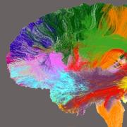 TAU-led project to create brain ‘atlas’ hailed a success